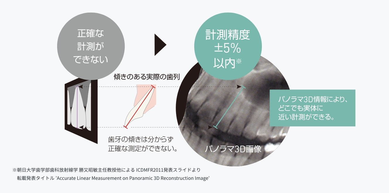 ※朝日大学歯学部歯科放射線学 勝又昭敏主任教授他による ICDMFR2011発表スライドより 転載発表タイトル ’Accurate Linear Measurement on Panoramic 3D Reconstruction Image’